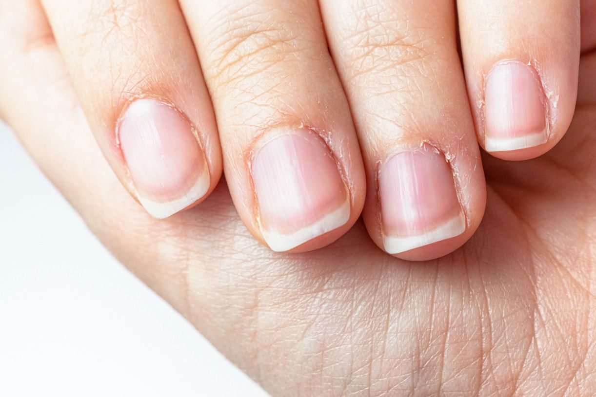 hands nails ręce paznokcie płytka paznokcie łamliwe paznokcie krem do rąk