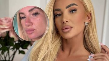 Izabela Macudzińska pokazała twarz bez makijażu i filtrów. Tak wygląda naprawdę [ZDJĘCIA]