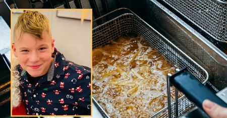 Gorący olej poparzył mu ciało. Właściciel frytkownicy ze Świnoujścia ukarany