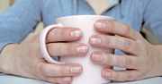 Pojawiają się na paznokciach. Lekarka wyjaśnia, kiedy wskazują na wyniszczone nerki