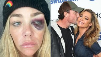 Denise Richards oskarża męża o przemoc. "Groził, że złamie mi szczękę. Często mnie GWAŁTOWNIE DUSIŁ"