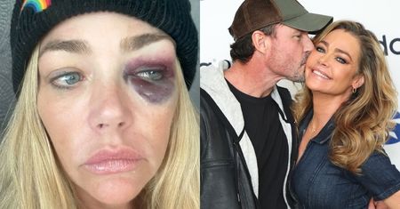 Denise Richards oskarża męża o przemoc. "Groził, że złamie mi szczękę. Często mnie GWAŁTOWNIE DUSIŁ"