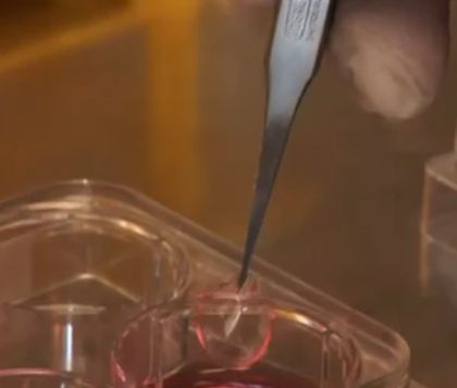 Soczewki kontaktowe z komórkami macierzystymi wyleczyły niewidomych (wideo)