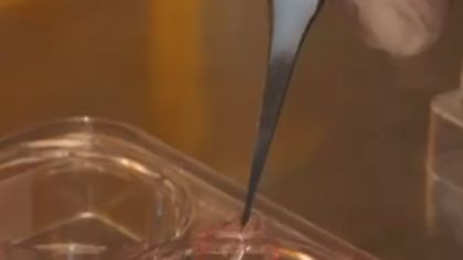 Soczewki kontaktowe z komórkami macierzystymi wyleczyły niewidomych (wideo) 1