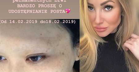 Uczestniczka "Top Model" chciała pomóc kobietom po chemioterapii. Została wykorzystana...