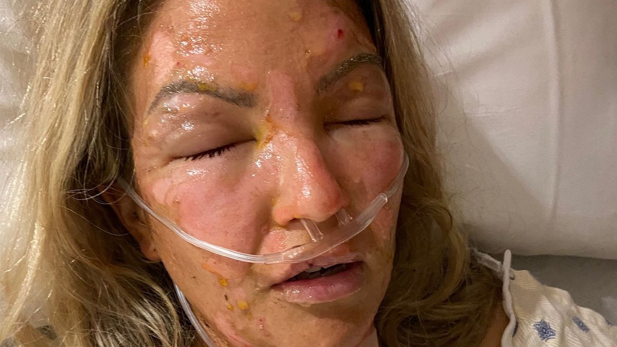 Ręce kobiety zapaliły się przy odpalaniu świeczki