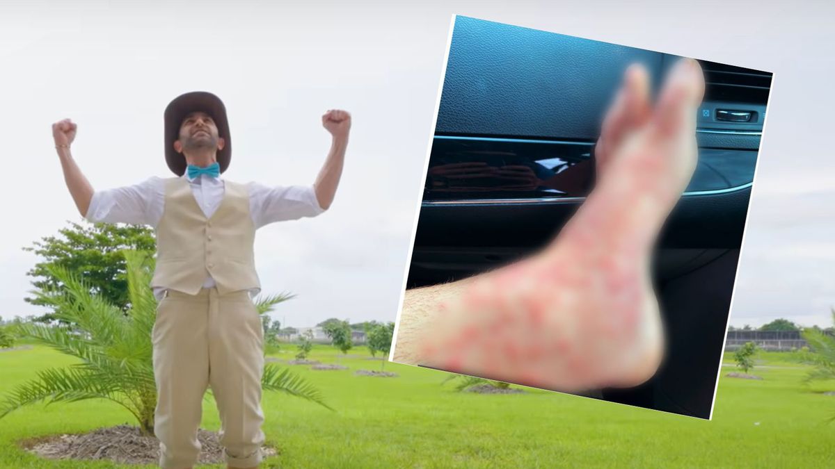 Przyrodnik wszedł do mrowiska pełnego ognistych mrówek