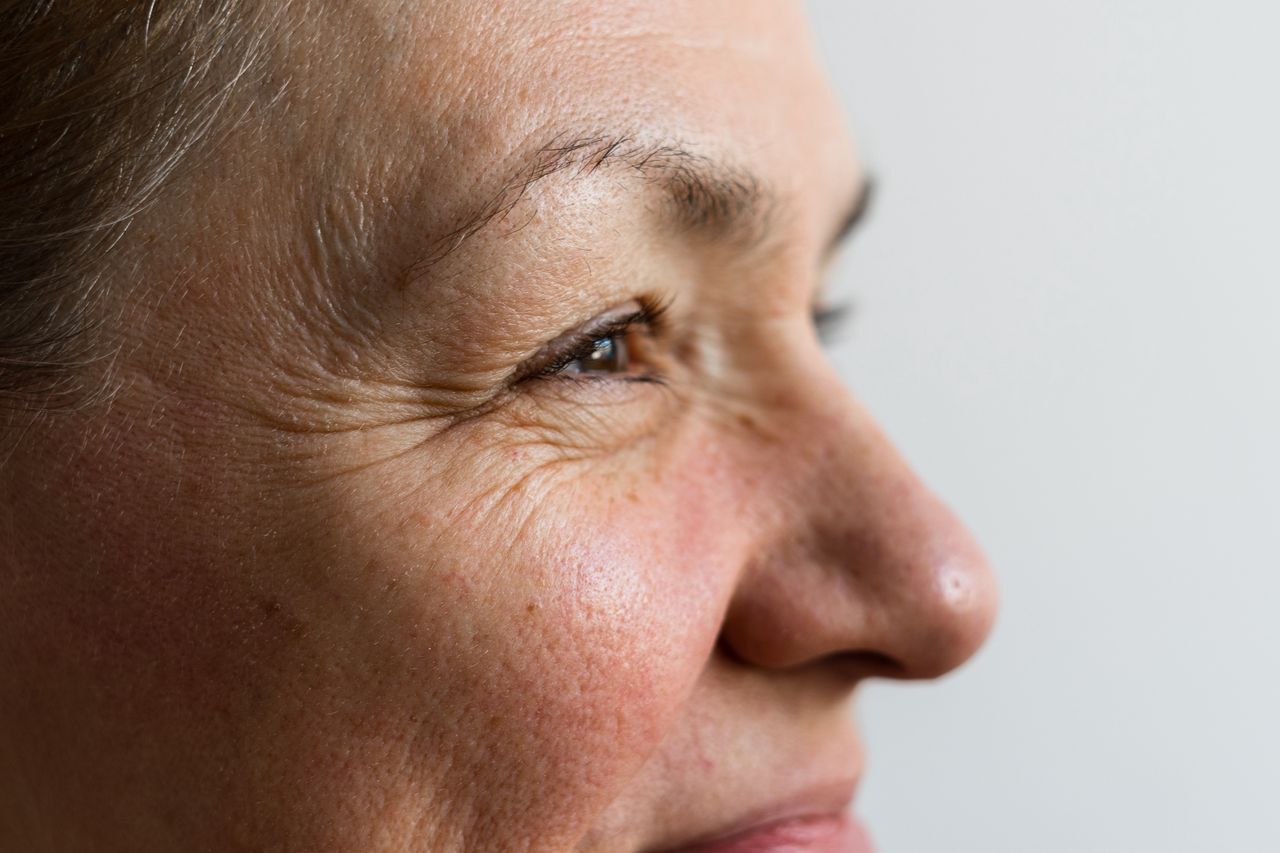 Egg whites: The natural wrinkle remedy taking the internet by storm