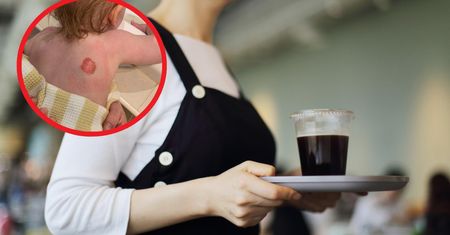 Kelnerka wylała kawę na roczną dziewczynkę. Nikt nie potrafił jej pomóc