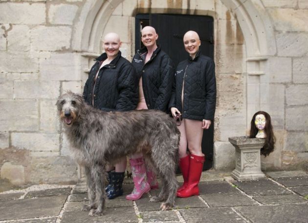 Akcja na rzecz łysych kobiet. Łyse jest piękne?