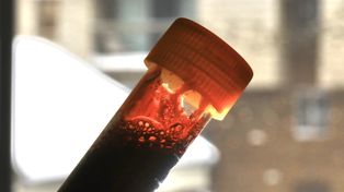 Wykryto go w krwi. Niepokojące wyniki badań na Śląsku