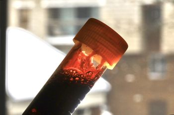 Wykryto go w krwi. Niepokojące wyniki badań na Śląsku