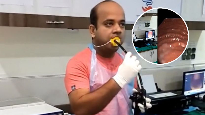 Gastrolog postanowił przekonać się, co czuje pacjent w czasie gastroskopii