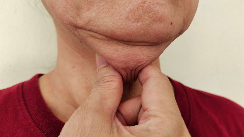 face, woman, skin, closeup, pain, body, health, fat, massage, lips, senior, mouth, acne, treatment, pimple, wrinkles, sagging, beauty, mole, rough skin, creased, blemishes, aging, process, overweight, crack, aesthetic, cosmetic, cosmetology, rejuvenation, patient, nourishing, pinch, hygiene, ages, flabby, under, wattle, freckles, complexion, serious, worried, illness, disease, problem, ugly, embarrassing, dermatologist, clinic