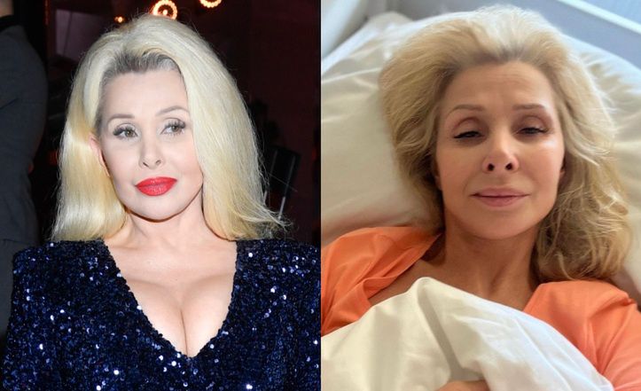Aldona Orman przeszła trzecią operację tętniaka mózgu
