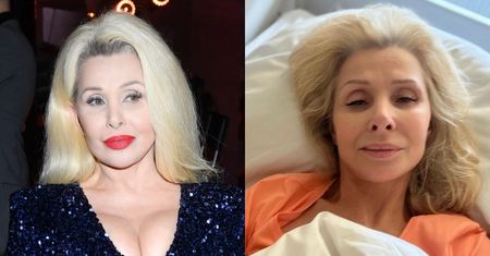 Aldona Orman przeszła trzecią operację tętniaka mózgu: "Mam znowu straszne bóle"