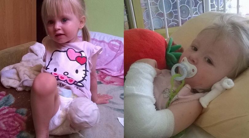 2-letnia Natalka straciła nóżkę przez pijanego kierowcę. Prośba o wsparcie