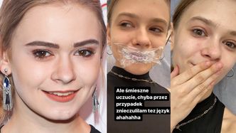 Stało się. 22-letnia Julia Wróblewska POWIĘKSZYŁA USTA: "To nie dlatego, że nie czuję się ładna" (ZDJĘCIA)