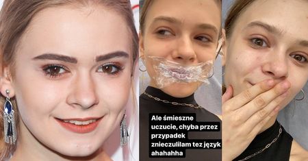 Stało się. 22-letnia Julia Wróblewska POWIĘKSZYŁA USTA: "To nie dlatego, że nie czuję się ładna" (ZDJĘCIA)
