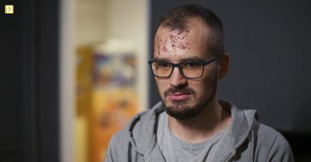 Maciek ze "Ślubu od pierwszego wejrzenia" poturbowany! Co się stało?