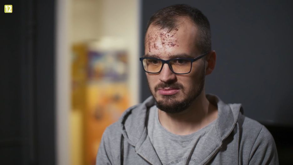Maciek ze "Ślubu od pierwszego wejrzenia" uległ wypadkowi.