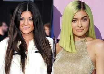 Kylie Jenner o powiększaniu ust: "Kiedy miałam 15 lat chłopak powiedział mi, że są małe"...