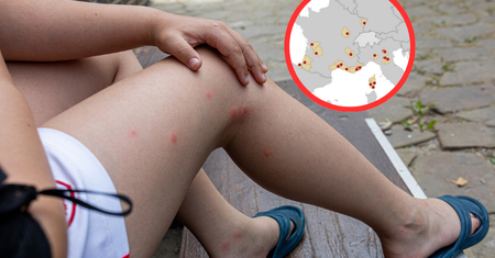 Coraz więcej przypadków wirusa chikungunya. Ekspert o charakterystycznym objawie