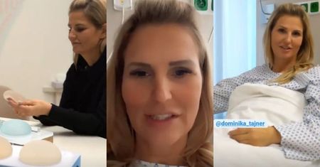 Dominika Tajner relacjonuje operację REKONSTRUKCJI PIERSI w czeskiej klinice (FOTO)