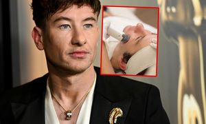 Barry Keoghan poddał się zabiegowi. "Czuję się lepiej ze sobą"
