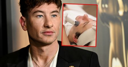 Barry Keoghan poddał się zabiegowi. "Czuję się lepiej ze sobą"