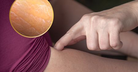 Mało kto zwraca uwagę. Podejrzany objaw wysokiego cholesterolu