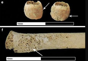 Rzymska okupacja nie wyszła Brytanii na zdrowie. Znaleźli dowody