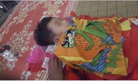 Zmarł 5-letni chłopiec zaatakowany przez rój os