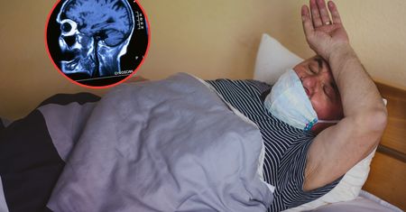 Miał bóle głowy, podejrzewali guza. W mózgu znaleźli coś innego