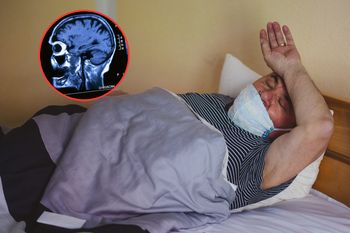 Miał bóle głowy, podejrzewali guza. W mózgu znaleźli coś innego