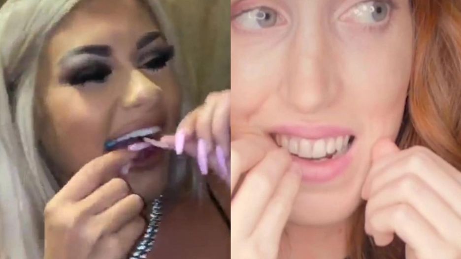 Niebezpieczny trend na TikToku. Nastolatki nitkują zęby włosami. Dentyści ostrzegają