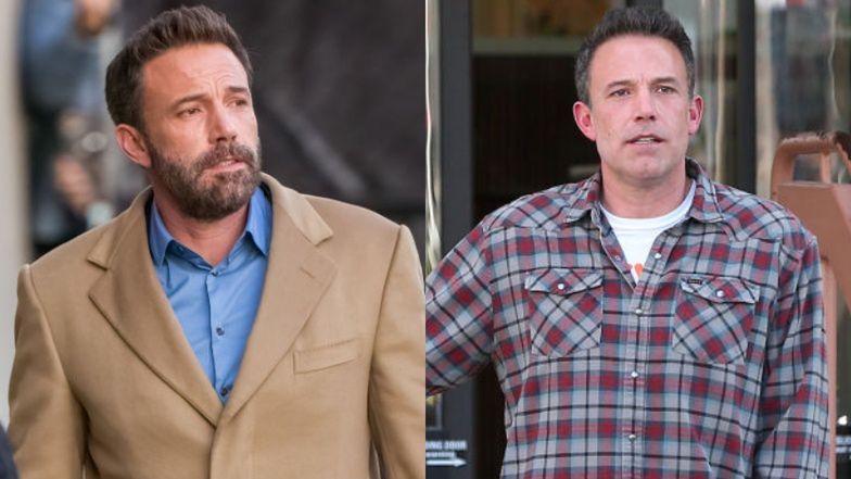 Ben Affleck też się ostrzykuje?
