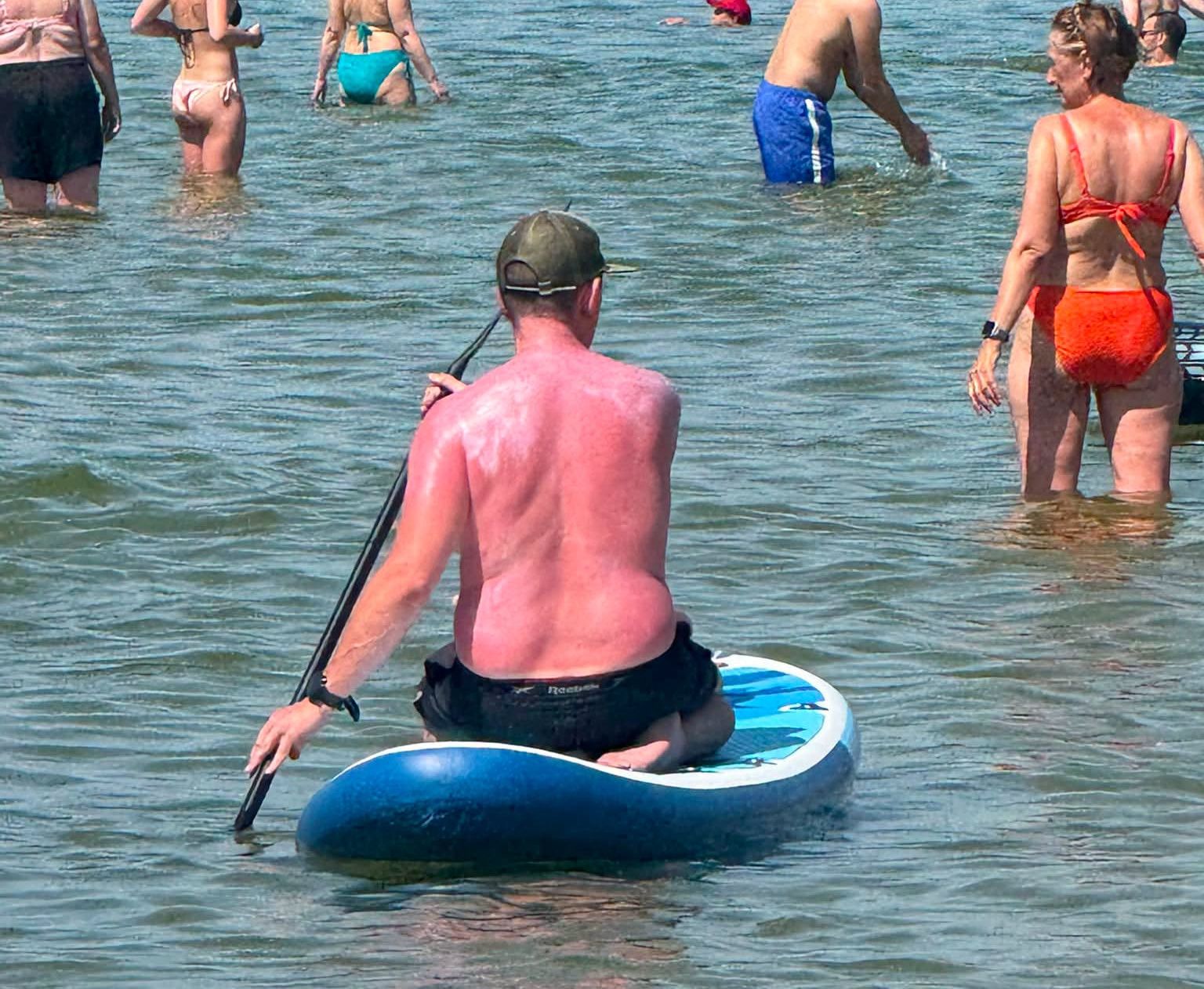 "Nie odróżniają opalenizny od oparzenia". Zdjęcie z Sopotu obiegło Internet