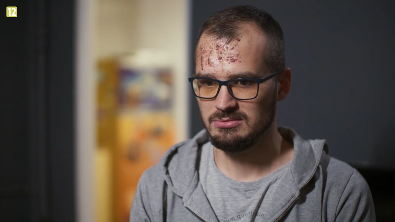 Maciek ze "Ślubu od pierwszego wejrzenia" uległ wypadkowi.