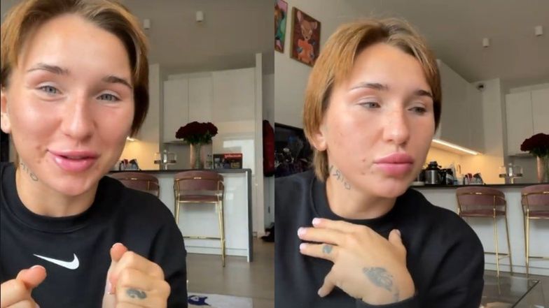 Marta Linkiewicz wraca do naturalnych ust