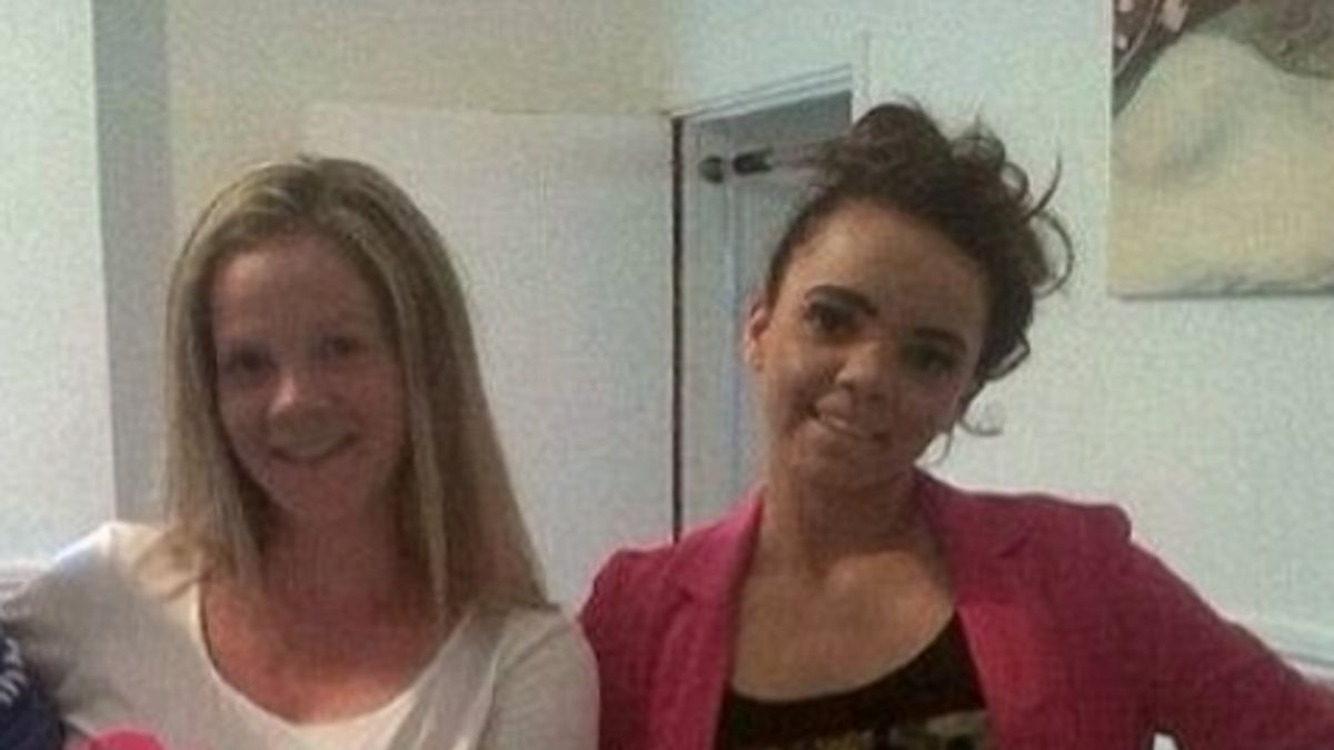 Matka i córka przed operacjami