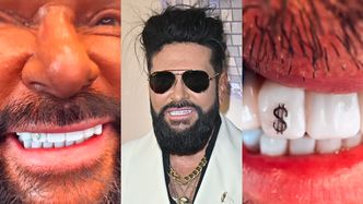 UWAGA, WAŻNE: Krzysztof Rutkowski sprawił sobie nową ozdobę. Teraz ma na zębie... DOLARA. Uśmiech "na bogato"?