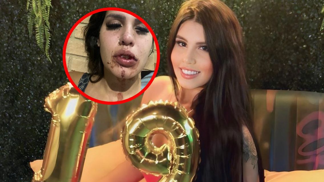 Nastolatka została brutalnie pobita