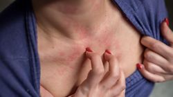 Sygnał alarmowy. Znak, że rak piersi mógł już zaatakować