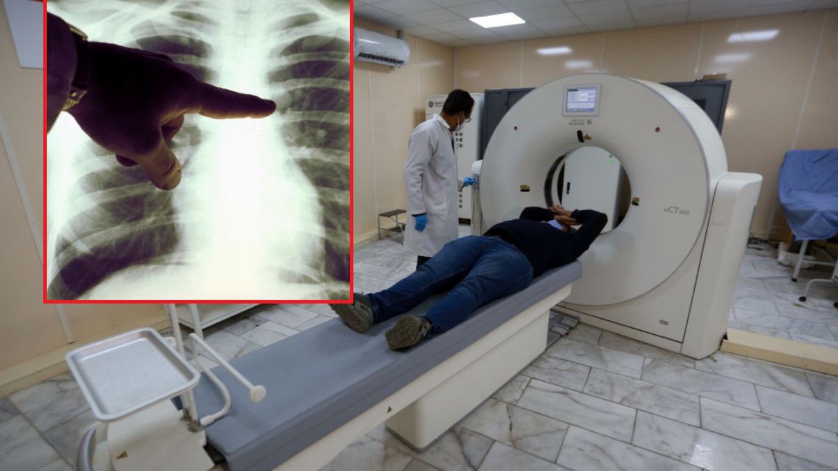 covid-19 koronawirus wuhan chiny