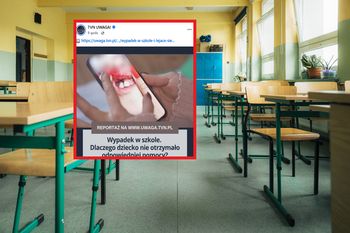Wypadek w szkole w Będzinie. 7-latka uderzyła twarzą w ławkę. "Byłam w szoku"