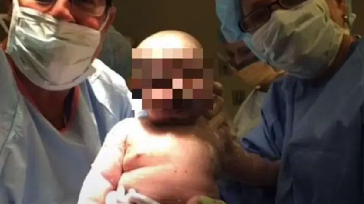 Dziecko urodziło się znacznie większe niż planowano