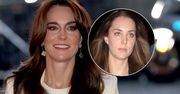 Księżna Kate miała operacje plastyczne? Ekspertka stawia sprawę jasno