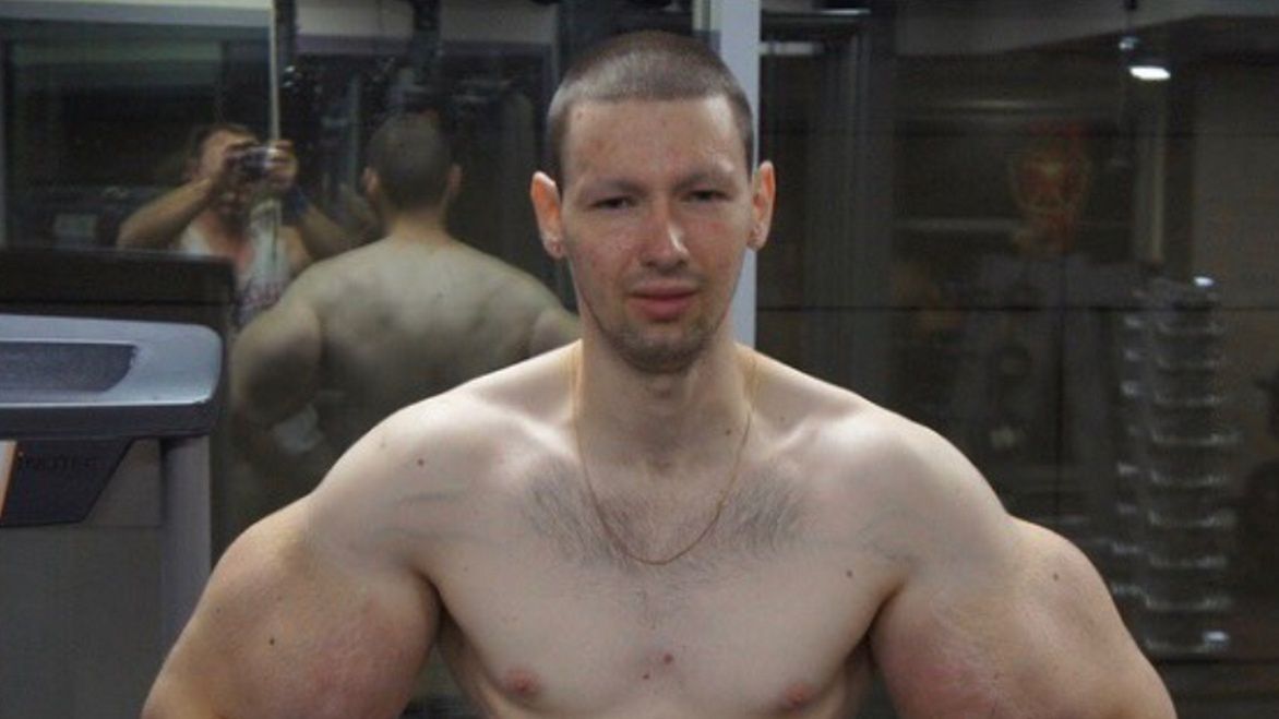 Rosjanin Kirill Tereshin wstrzyknął sobie wazelinę, aby mieć muskularne bicepsy.