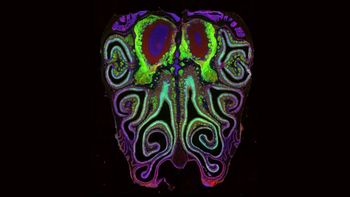 Wszyscy mają je w nosie. Naukowcy stworzyli ich mapę